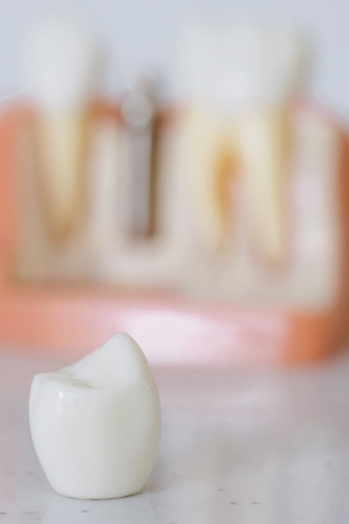 Close Up Photo of an Implant Tooth